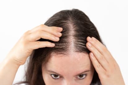Tru-Skin Blog - Understanding Postpartum Hair Loss