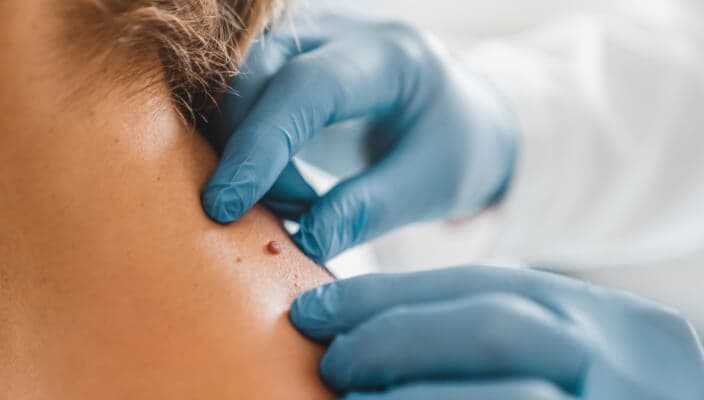Tru-Skin Blog - Protect Your Skin: The Importance of Regular Screenings in Texas
